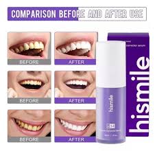 Blanqueador Dental HISMILE V34