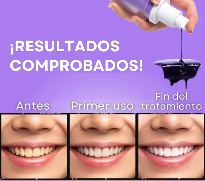 Blanqueador Dental HISMILE V34